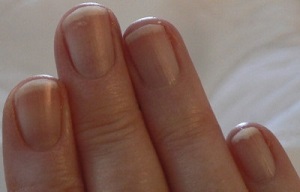 Survivopedia Finger Nail Beds Health