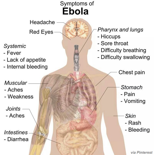 ebola symptoms