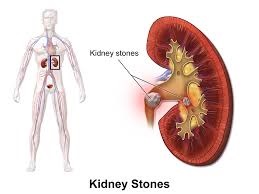 Human body and kidney detail