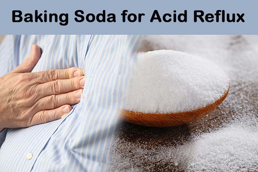 Baking Soda for Acid Reflux