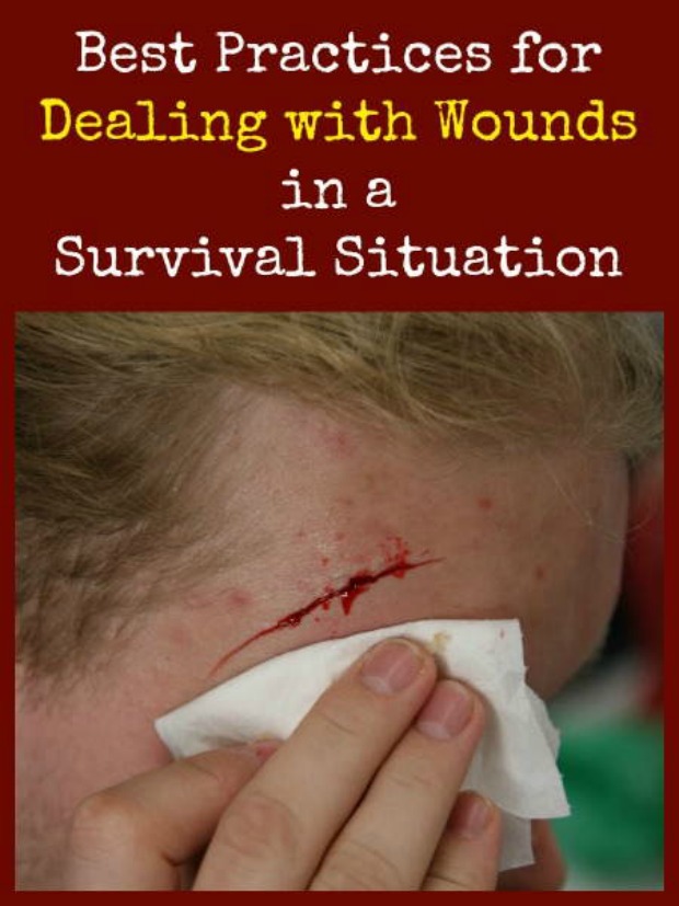 Dealing with wounds 