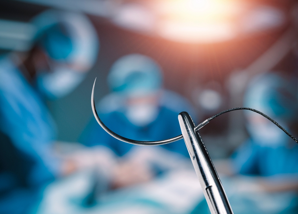 Stopping Bleeding, Cleaning, Closing, and Monitoring Without a Doctor – Survivopedia